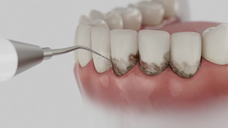 Trusted Tooth Extraction service in Citrus Park, AZ - Dentist Open Now